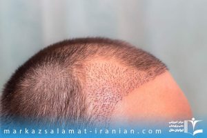 ساختمان تارهای مو