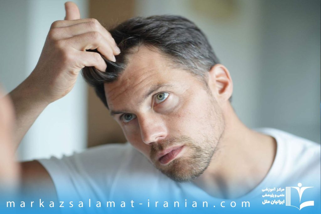 21 مورد از عوامل ریزش مو در مردان که باید بدانید
