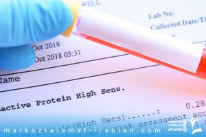 آزمایش پروتئین خون