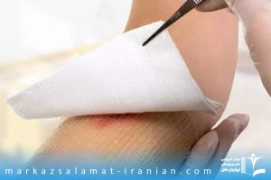 نسل جدید پانسمان