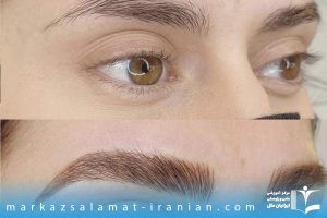 دوره آموزش کاشت ابرو در شیراز