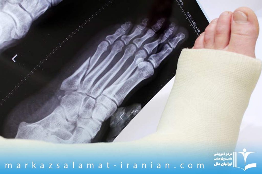 آسیب های اسکلتی