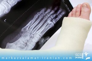 آسیب های اسکلتی