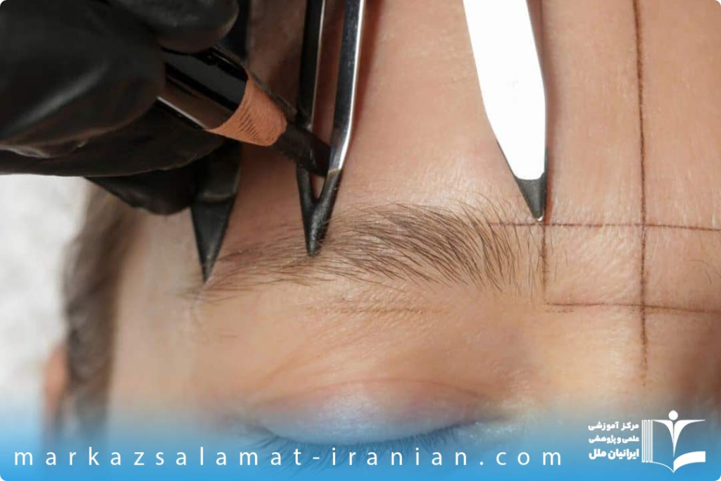 تفاوت کاشت مو و کاشت ابرو