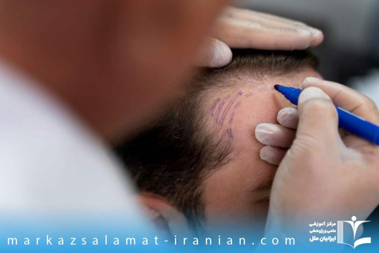 با مدرک کاشت مو کجا می توان استخدام شد؟